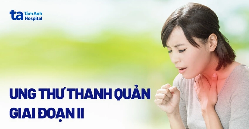 Ung thư thanh quản giai đoạn 2: Nhận biết sớm, tiên lượng tốt