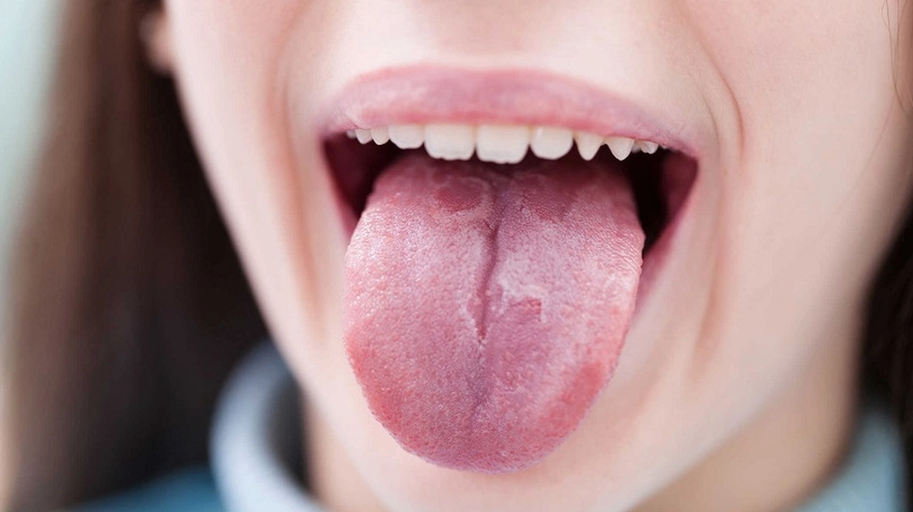 Ung thư vòm họng giai đoạn đầu những hình ảnh và dấu hiệu cần biết