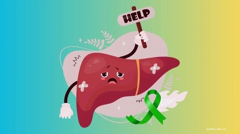 Vàng da vàng mắt là dấu hiệu điển hình của ung thư gan giai đoạn cuối