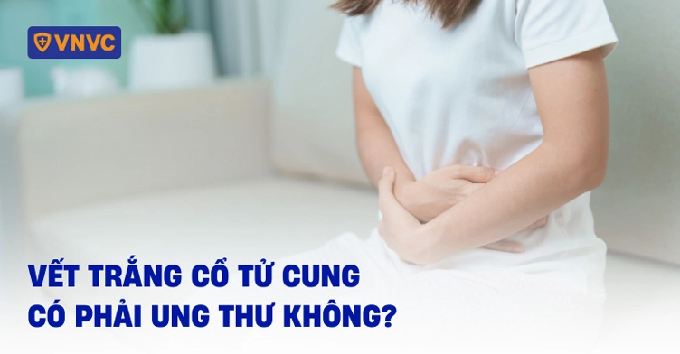 Vết trắng cổ tử cung có phải ung thư không? Nguyên nhân và cách xử lý