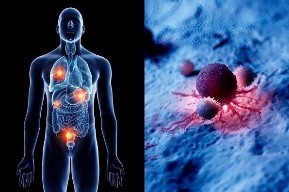 Xạ Trị Nông Bằng Tia X: Chuyên Sâu Từ Đại Cương Đến Chỉ Định