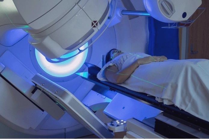 Xạ trị trong phác đồ điều trị ung thư đại tràng