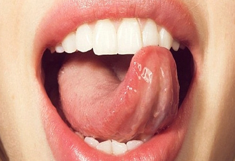 Xạ trị ung thư lưỡi: Phương pháp, hiệu quả và những điều cần biết