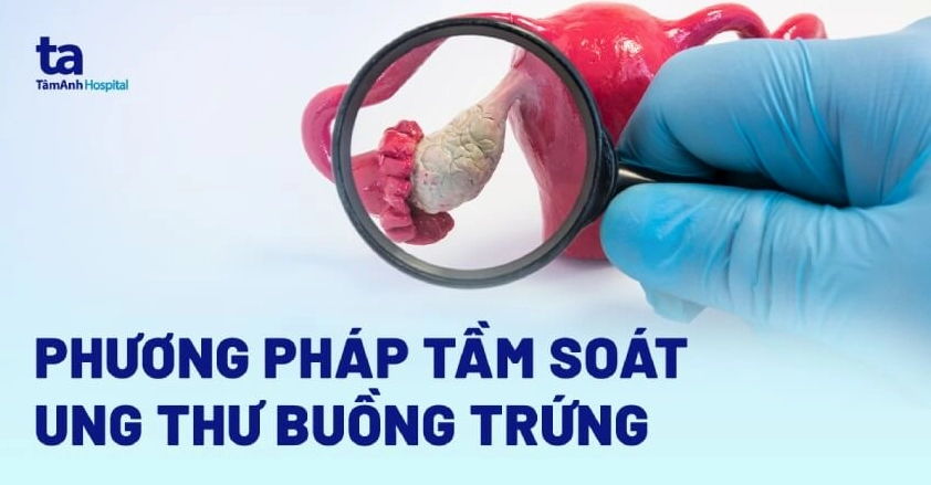 Xét nghiệm ung thư buồng trứng như thế nào để phát hiện sớm?